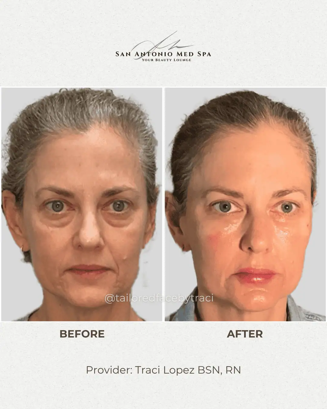 patient-result-front