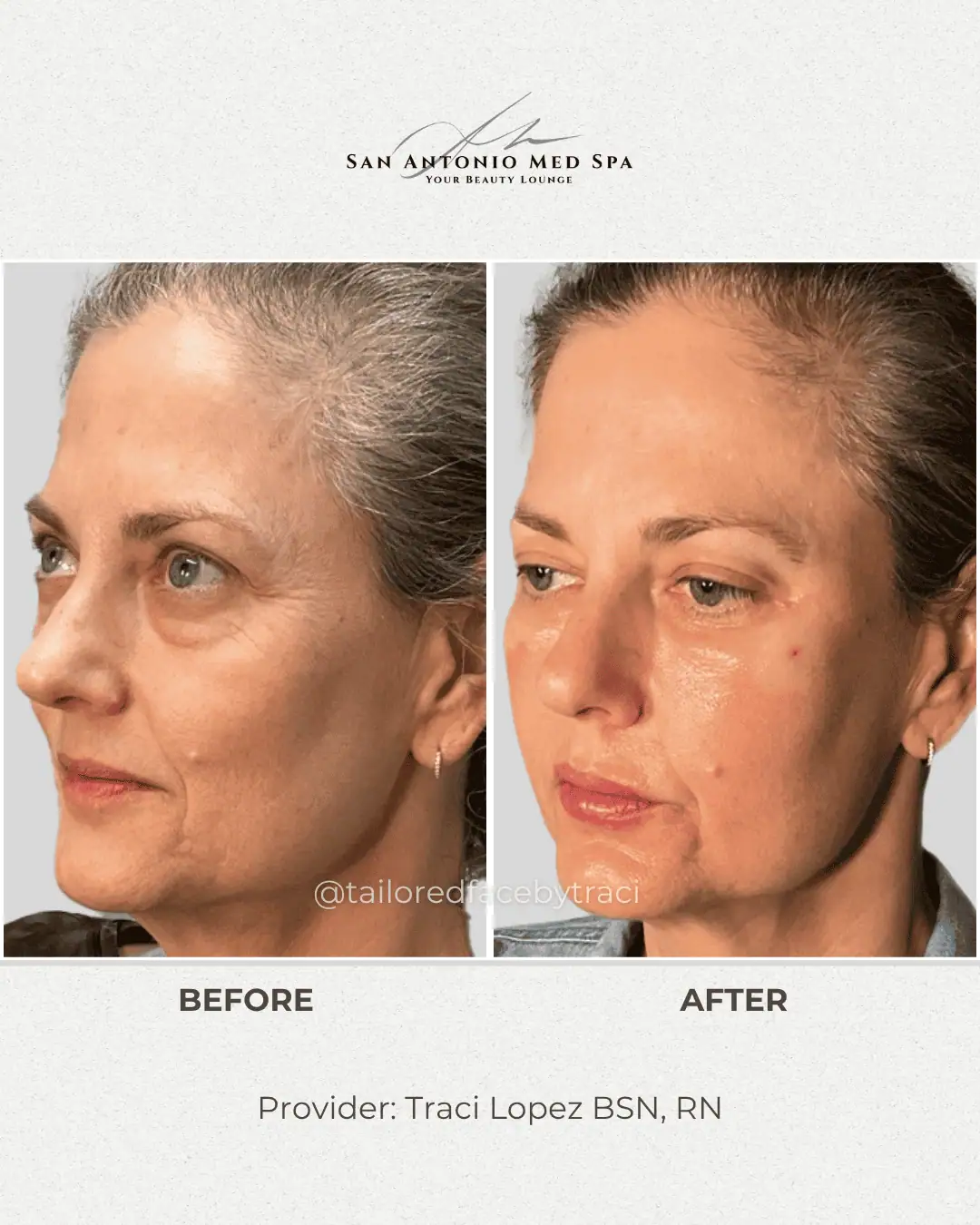 patient-result-left