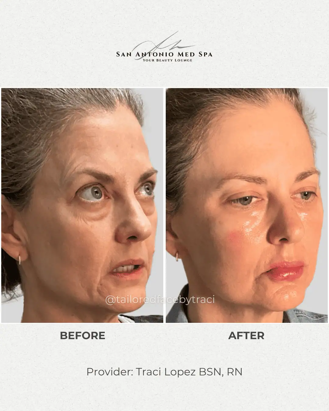 patient-result-right