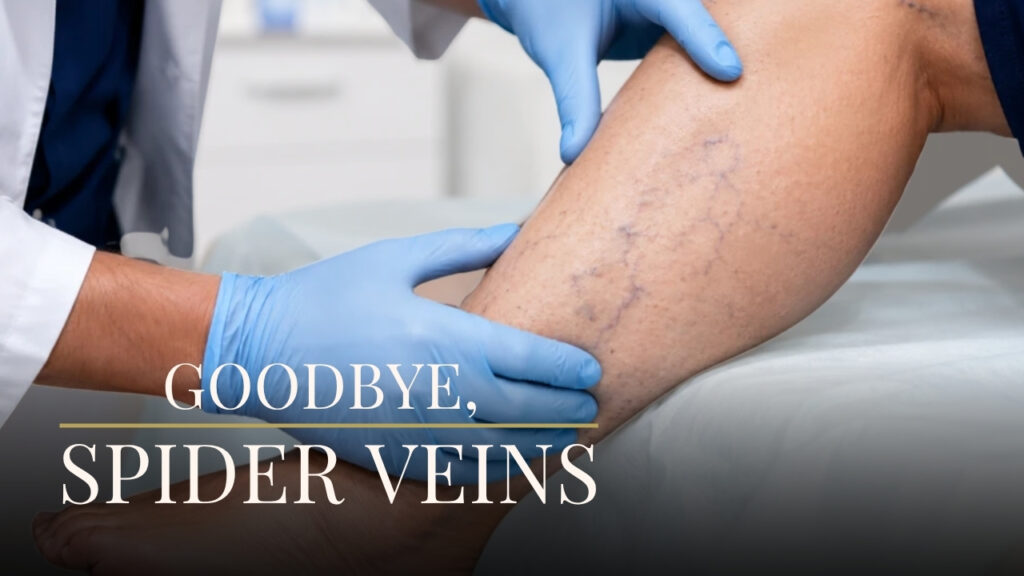Laser-Vein-Treatment.jpg