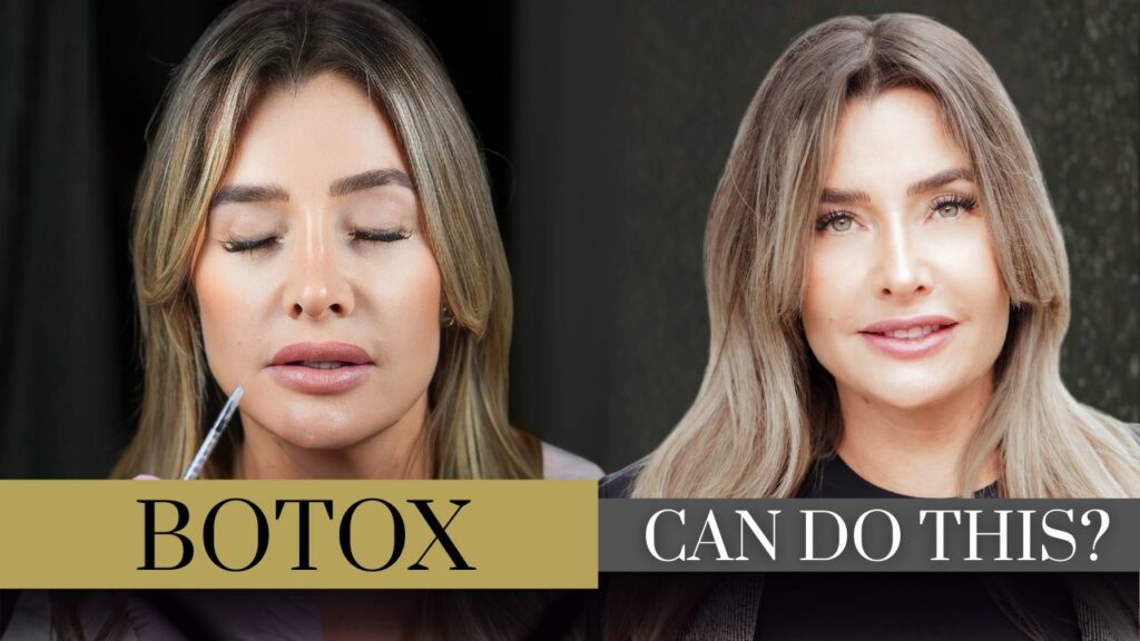 5-Areas-You-Didnt-Know-Botox-Can-Soften-1.jpg